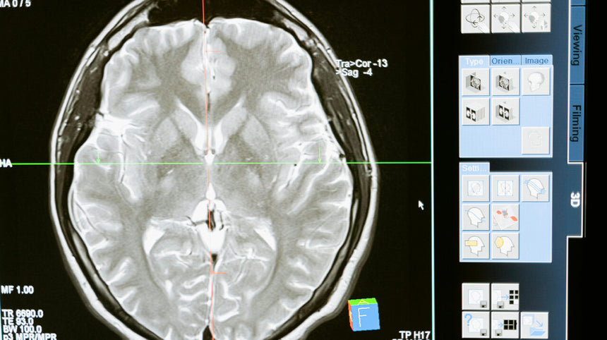 Radiografia al cervello